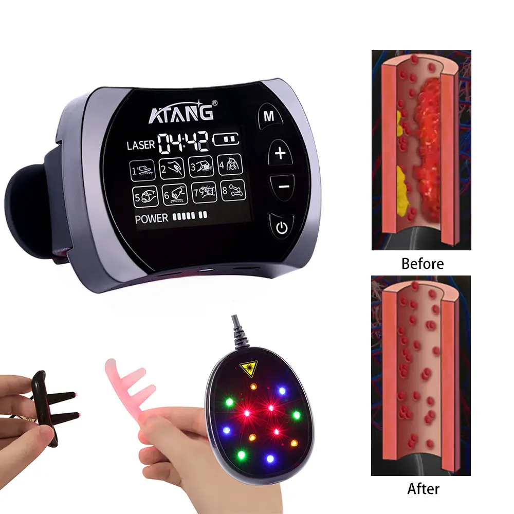 ATANG Promote blood circulation wrist watch blood glucose meter EMS equipment diabetes care laser treatment watch