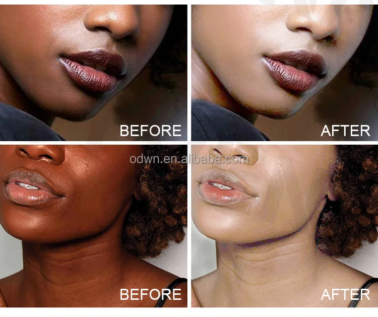 Oem Pimples Melasma blemish brighten dark spot corrector remover cream Strong bleaching whitening face freckle remove cream