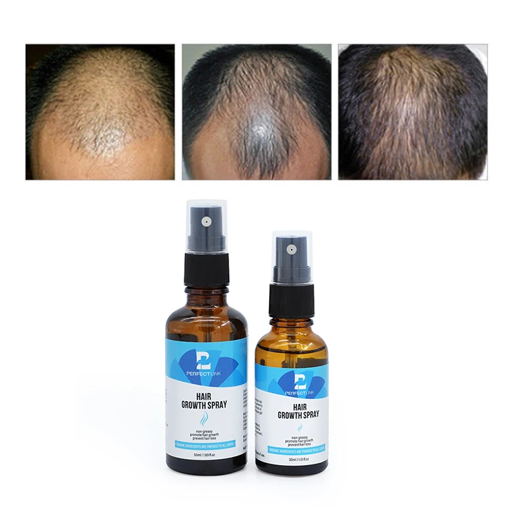 OEM Free Sample Strengthen Hair Follicles New Men Hair Grow Spray Herbal Extract Hair Growth Spray Effective 30ml