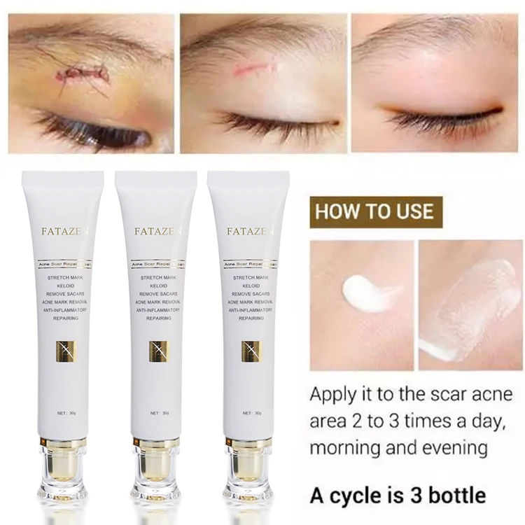 Strong Effective Acne Scar Removal Cream Pimples Stretch Marks Remove Face Gel Tummy Tuck Tightening Stretch Mark Removal Cream