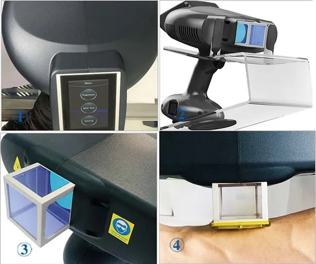 Peninsula 308 nm uvb Excimer Laser System Home Use Phototherapy UV Lamp Excimer Laser Vitiligo For Vitiligo Psoriasis Treatment