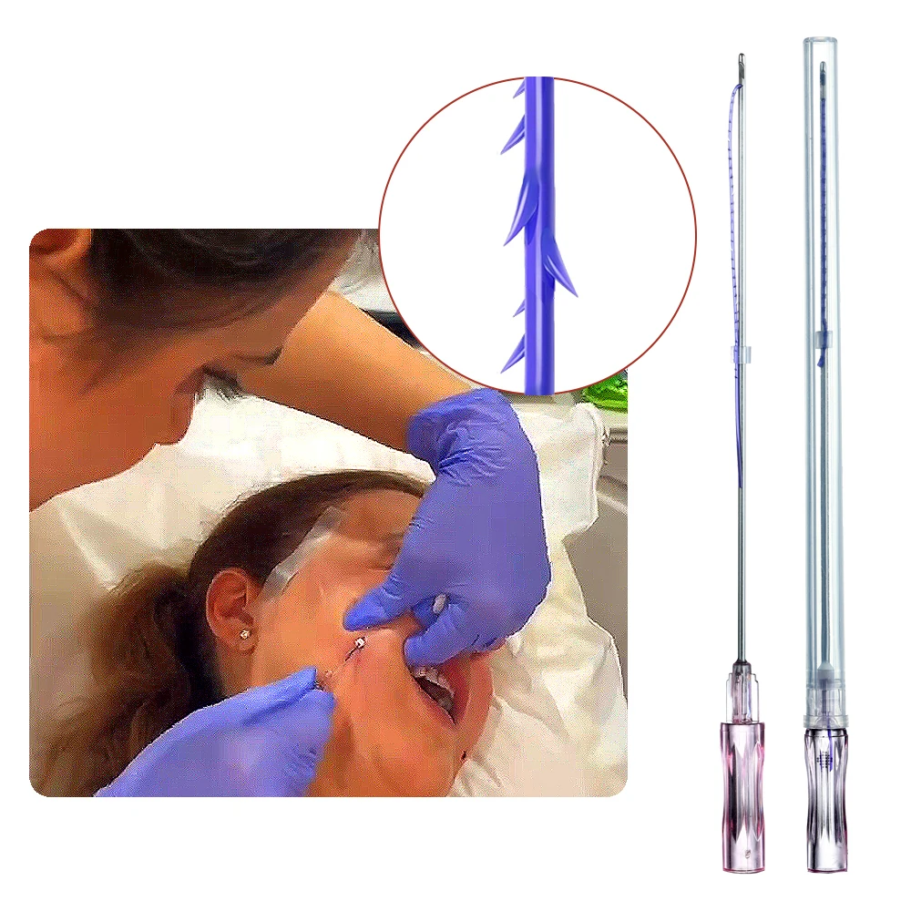 Spa V Face Cog Lift Facial Pdo Wires 18g 100mm L Thread Lift 4d Cog Fili Pdo Pcl  Hilo Pdo Especulados