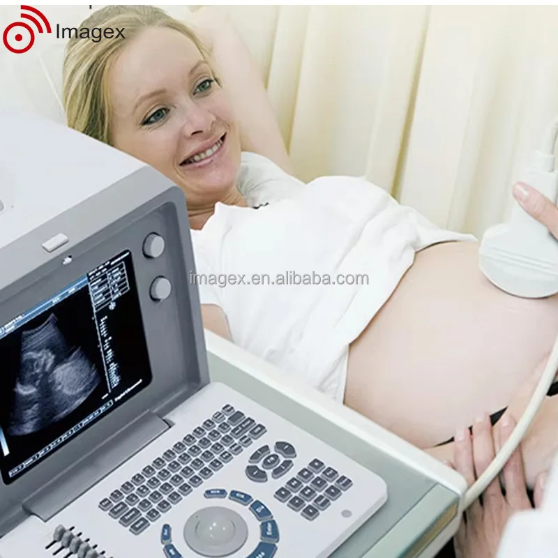 Imagex best portable ultrasound machine for sale