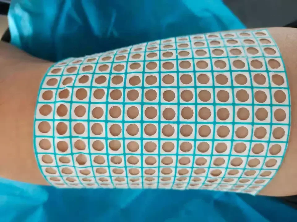 X-ray Detectable Locator Surgical Disposable Puncture Positioning Tape