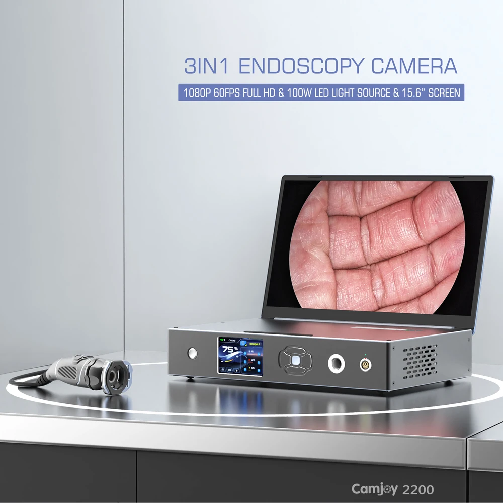 Medical ENT full HD Endoscopy Unit Portable Endoscopic laparoscopic camera