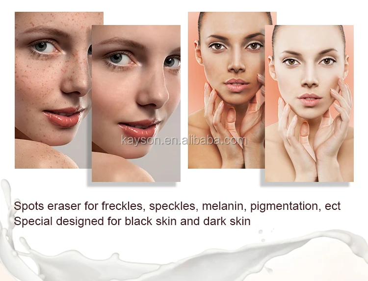 Anti Freckle Removing Royal Expert Aloe Vera 24K White Gold Pearl Whitening Cream Italy
