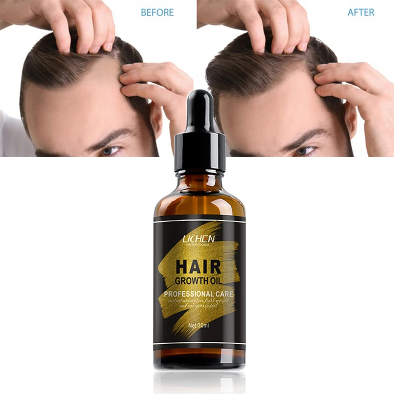 hot selling china indian natural hair growth oil custom logo herbal oil for men hair growth