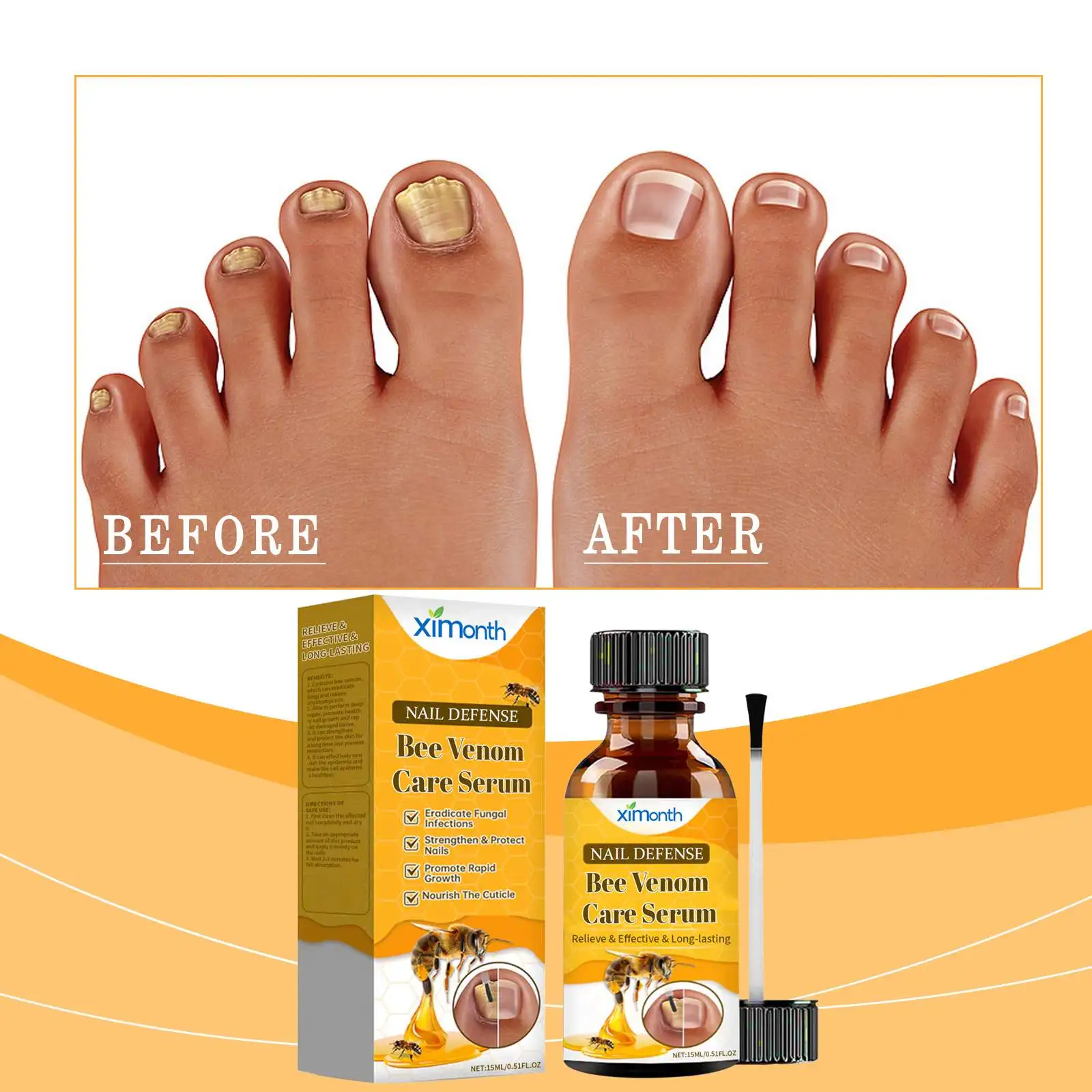 XIMONTH Wholesale Natural Herbal Bee Venom Foot Hand Toe Nail Fungus Anti Treatment Liquid Serum Essence 15ML