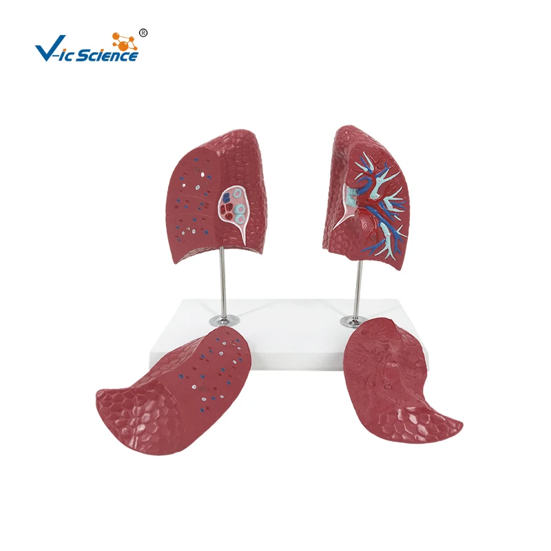 Anatomical PVC 4 Parts Model of the Lungs for Medical Science