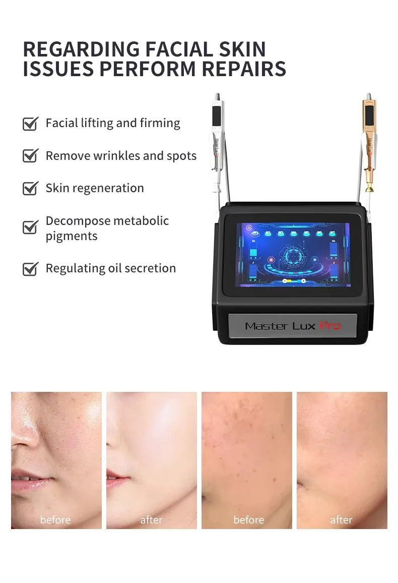 2 In 1 Plasma Beauty Machine Flash Plasma+ozone Plasma Facial Lifting And Firming Removing Spots And Wrinkles Anti-aging