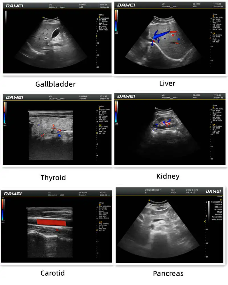 DAWEI F3 Obstetrics and Gynecology Diagnostic Ultrasound Scanner Medical Equipment