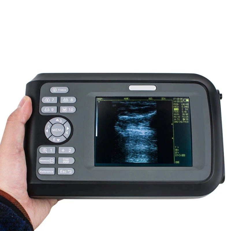 Veterinary Handheld WristScan Ultrasound Scanner Machine Handscan Monitor for Farm Animals and Pets