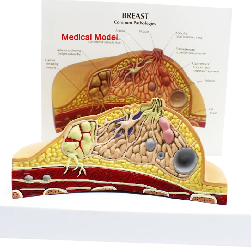Medical Anatomy System Human Pathology Breast Model For Female Breast Healthy