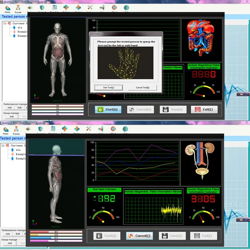 Multi Language Body Scanner Download Quantum Resonance Magnetic Analyzer for Testing Body Latest Generation Detection Device
