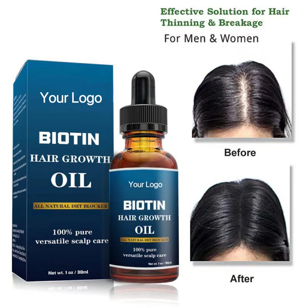 Wholesale 30ml/60ml Hair Growth Essential Oil For Hair Loss Treatment Regrowth Serum