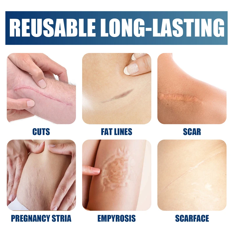 Jaysuing silicone anti scar gel hydrating repairing softening smoothing scars empyrosis fat line pregnancy stria removing gel