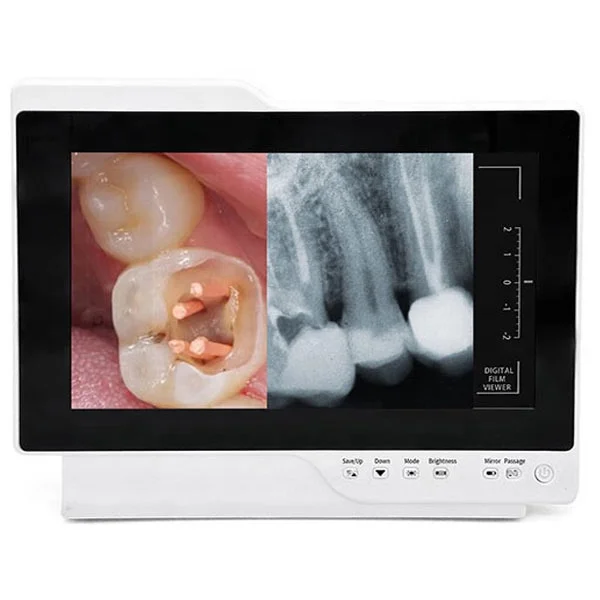 Portable Dental Camera Monitor intra oral camera dentaire endoscope