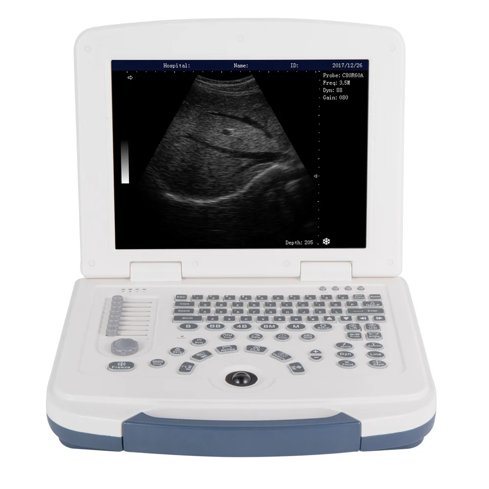Best Price Medical Diagnostic Equipment 12.1 Inch LCD Display Full Digital B/W ultrasound Machine