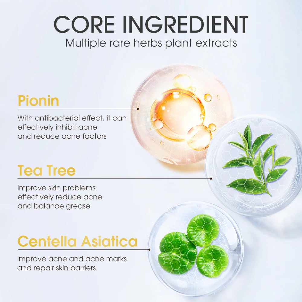 SKINEVER Salicylic Acid Ice Sleep Masque Cream Acne Treatment Face Body Mask Crystal Cleans Pores Fades Acne Marks Relieves