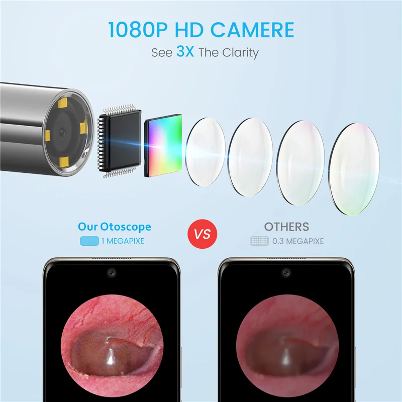 Endoscope Cheap and Fine Digital Otoscope with Camera Ear Household Portable Made in China Endoscope