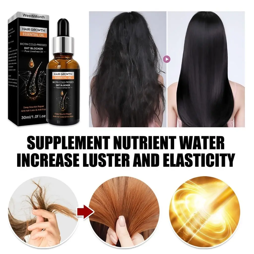 Opal OEM China Best Premium custom logo men herbs Ginger hair growth oil original dht blocker hair growth oil