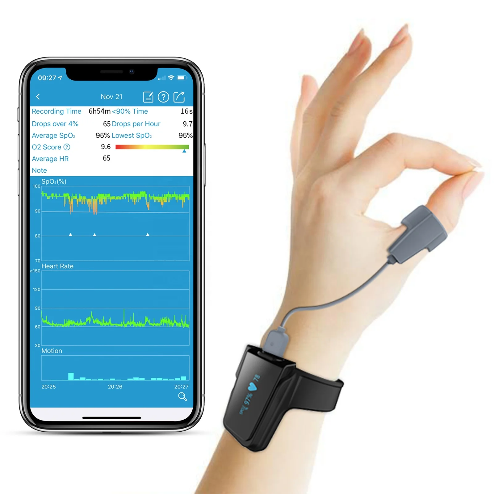 Wellue Checkme O2 Max Rechargeable Pulse Oximeter Heart Rate Variability Monitor Sleep Apnea Monitor
