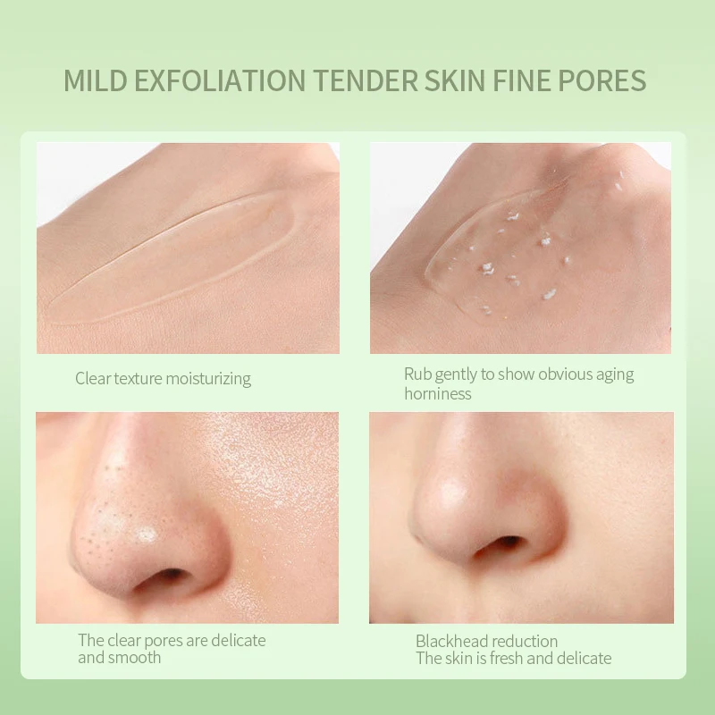 Private Label Deep Cleansing Gentle Peeling Soothing Exfoliant Gel Aloe Vera Exfoliating Gel For Face