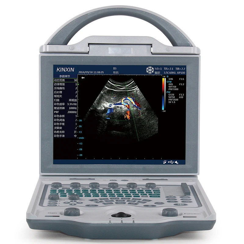 Portable 4D Full Digital Color Doppler Diagnostic Ultrasound Machine Price DCU12