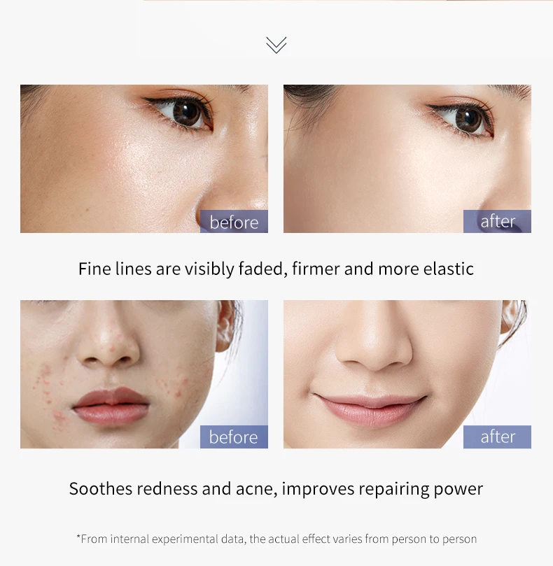 Private Label Organic Moisturizing Korean Skincare Products 5pcs Blue Copper Peptide Retinol Anti Aging Facial Kit Skin Care Set