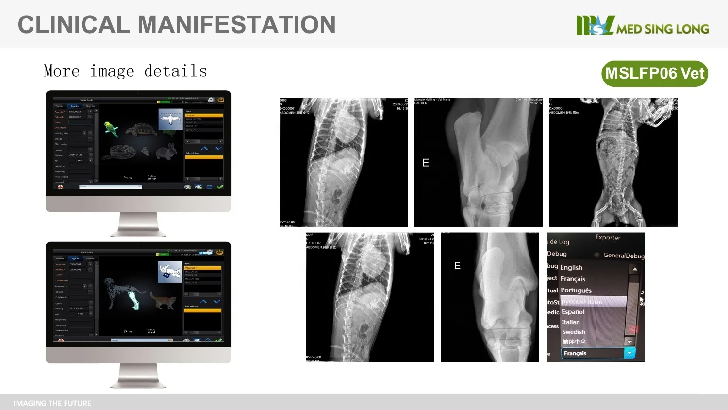 Панельный детектор flat iray 17*17 беспроводной плоский панельный mars 1717 качество с dr