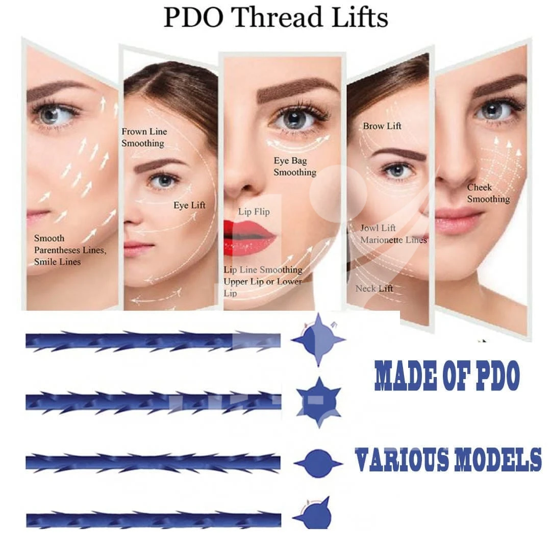 Manufacturer Supplier TOP-Q Phoenix Threads Pdo Discount Mono 29g 38mm Chin Pdo Threads Lift