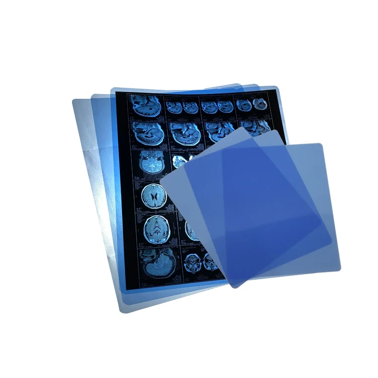 Nanjing Factory Wholesale Accurate And True Image Blue Dental X Ray Film For Kodak Printer