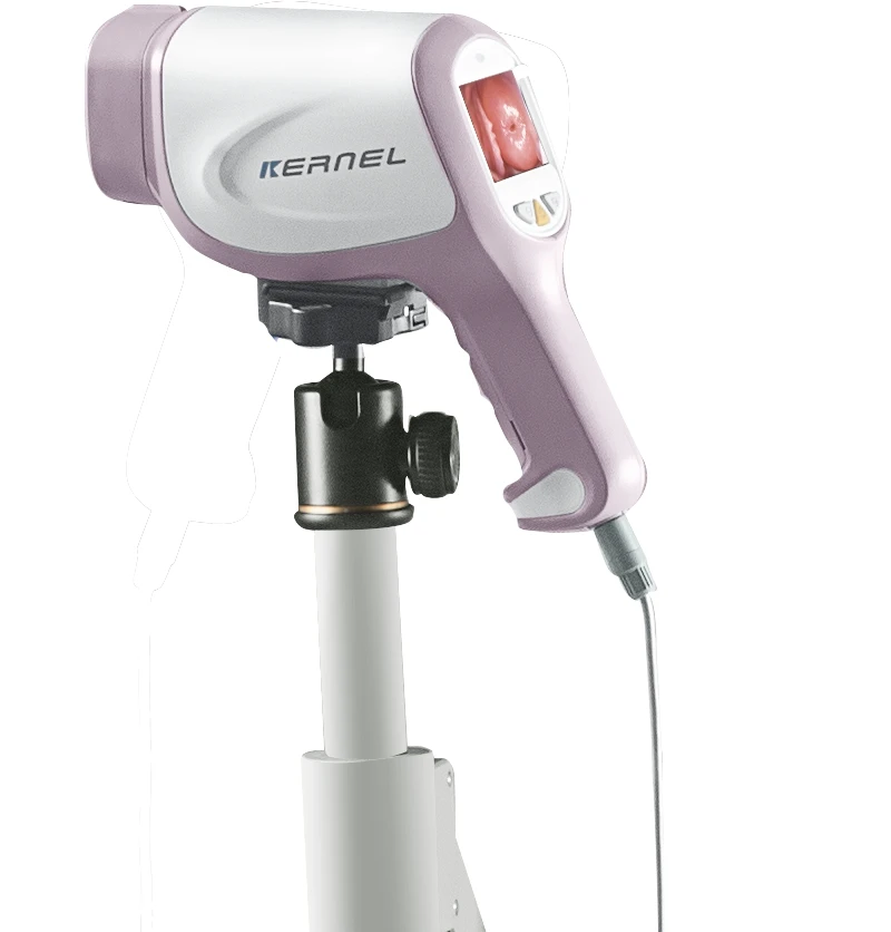 Kernel KN-2200IH Mega clear CE MEDICAL Hot sale video colposcope supplier colposcope price video colposcopia