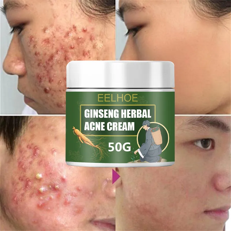 Hiseeu Day Female Moisturizer Face Cream Anti Acne Cream Free Sample Free Design Skin Care Set Lightening Cream Moisturizing