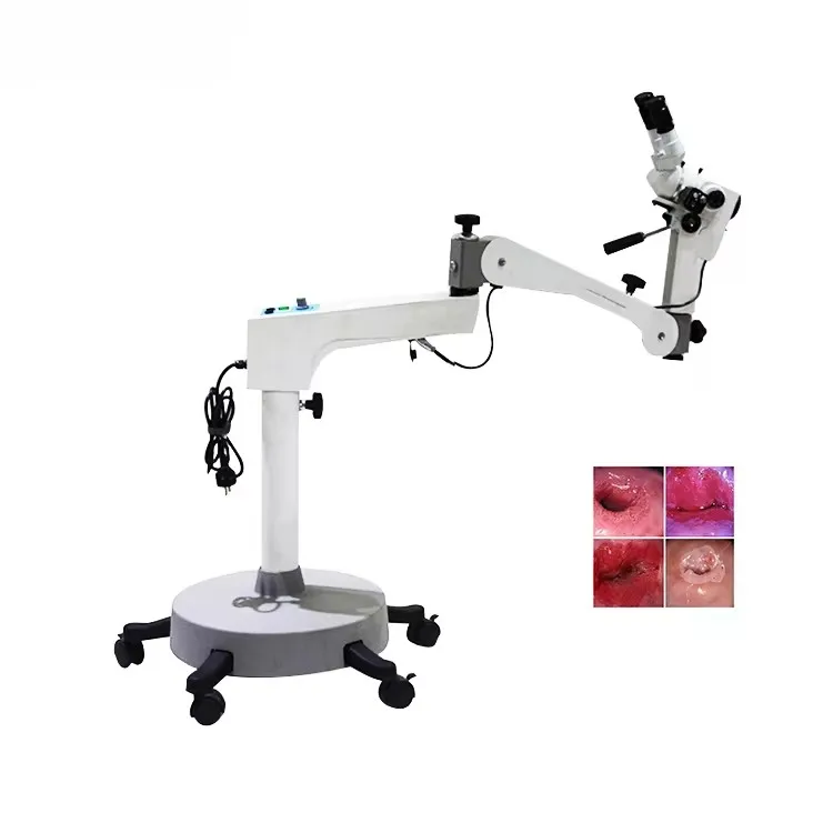 Digital colposcope endoscope camera Electronic video colposcope manufacturers colposcopy obstetrics and gynecology equipment