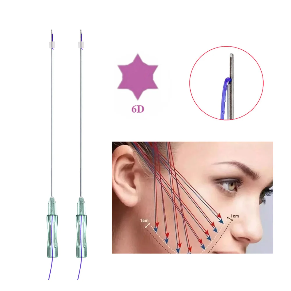 Korean V Hilos Tensores 21G 100mm Face Lifting Barbed Type L 6D Cog Lift Pdo Thread