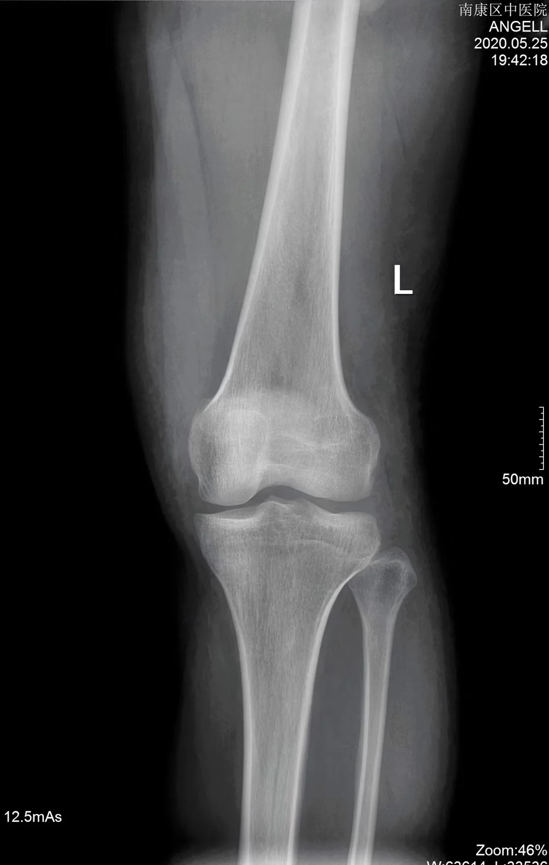 Konida medical dry film , agfa dt2b xray camera