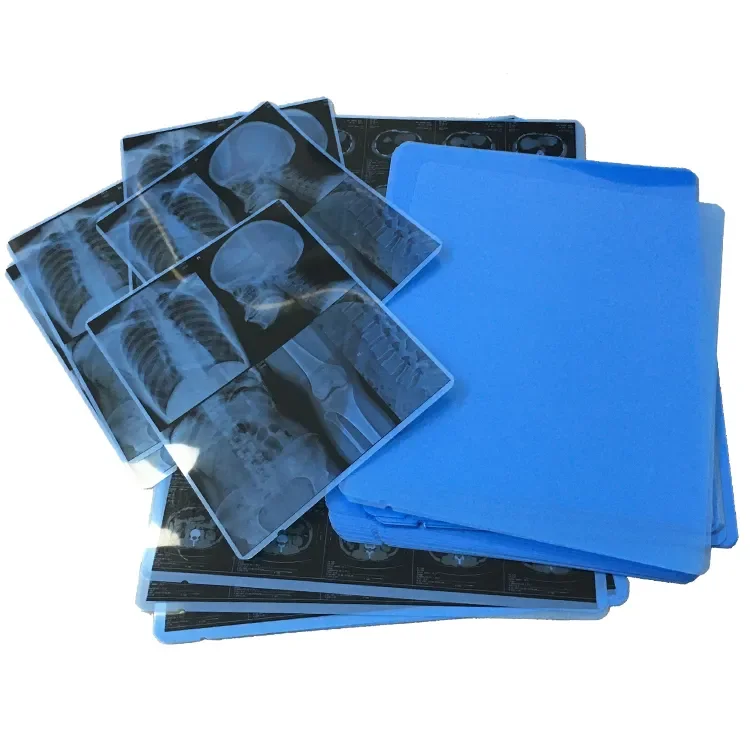 Wholesale A3 Custom Size Sheets Rolls Blue Inkjet Medical Film for Medical Image Printing X Ray CT, CR, DR, MTR, PET-CT etc.
