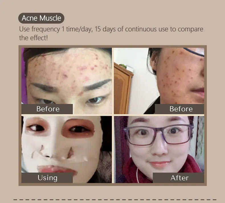 Hotsale Natural Warm Amazonian White Clay Facial Mask Sheet Face Mask