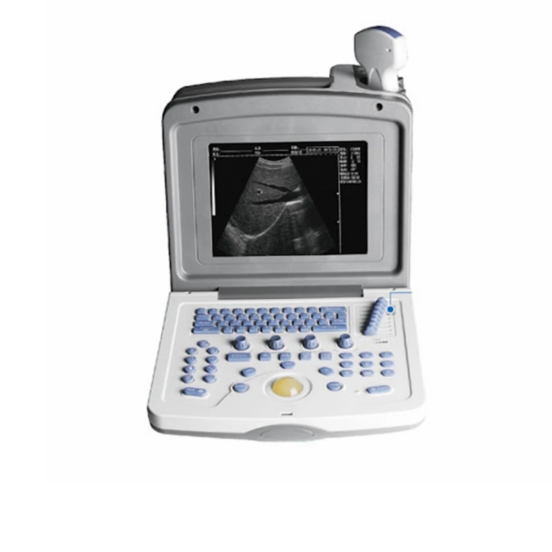 Ультразвуковой аппарат для медицинских и цифровых ноутбуков, ультразвуковой сканер с выпуклым пробным вагинальным зондом