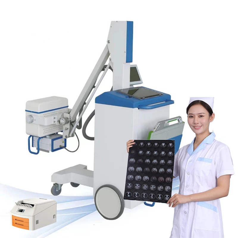 Недорогой цифровой рентгеновский аппарат 100