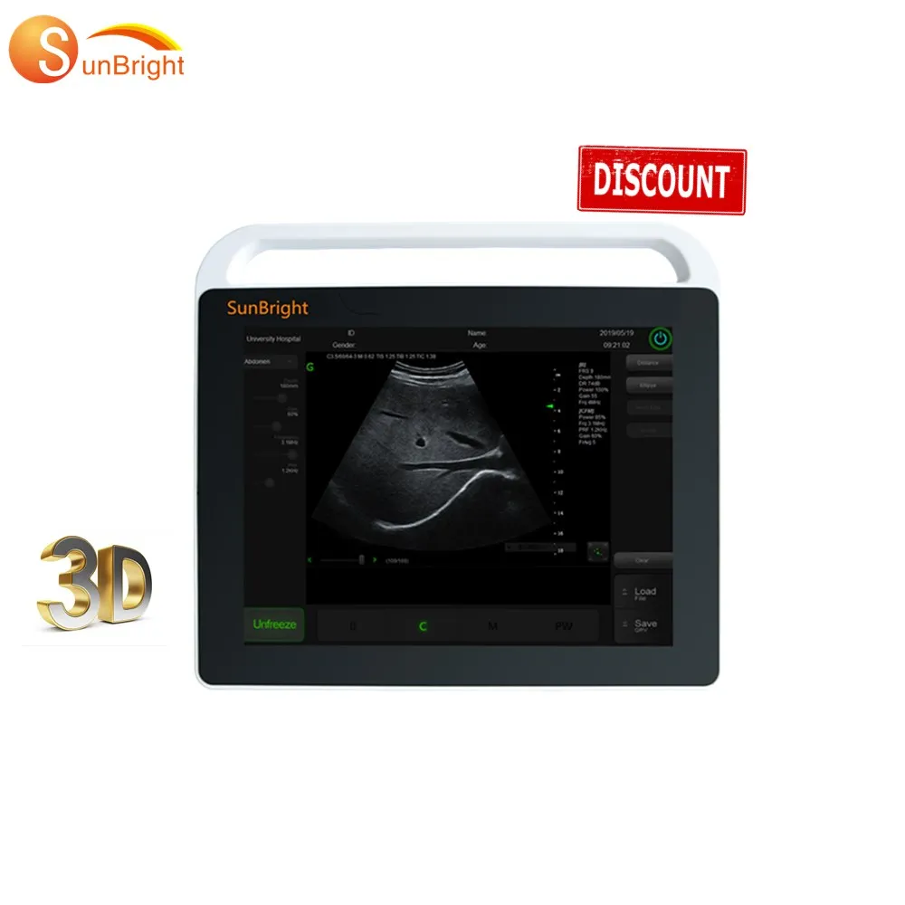  Оптовая цена ультразвуковой аппарат для ноутбука с сенсорным экраном OB/GYN 15 дюймов портативный сканер в