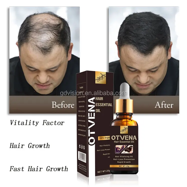 Сертифицированный лосьон для роста волос, ускоряет метаболизм клеток волос, предотвращает выпадение волос