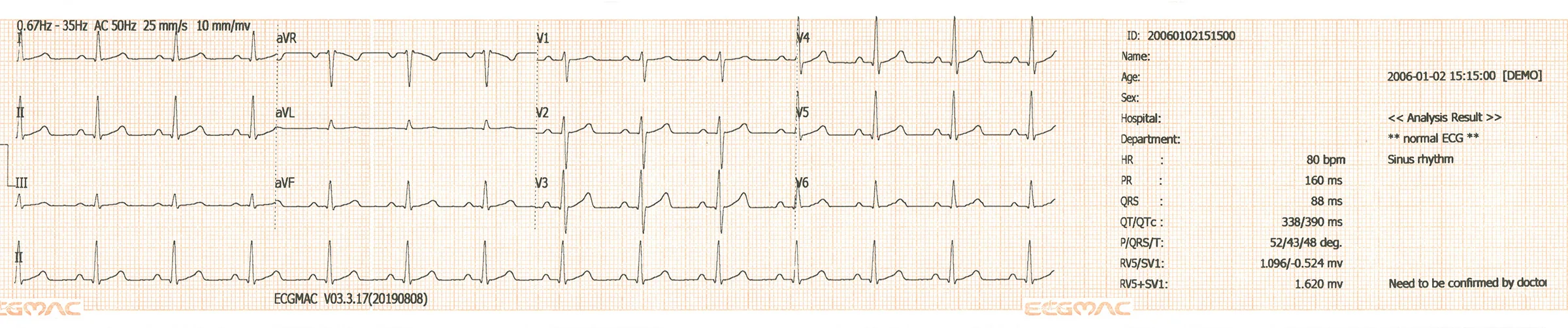 Portable ecg digital printer ekg device 12 channel ecg machine