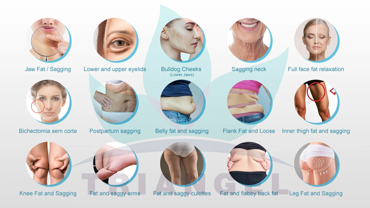 2023 Top Selling professional optical fiber face lifting facial lipolysis 1470nm endo laser machine