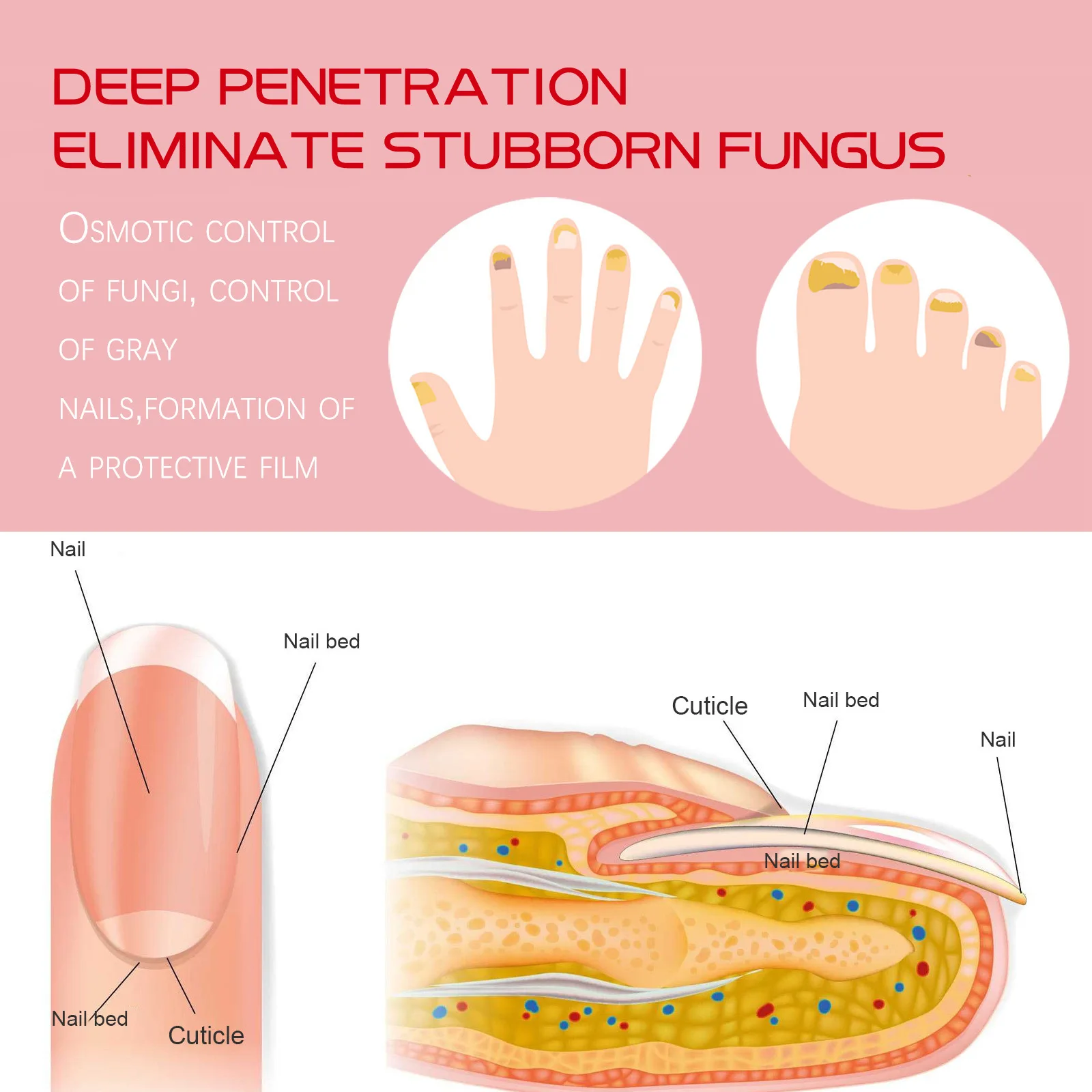 Feet Care Nail Foot Whitening Toe Nail Fungus Removal serum Gel Anti Infection Paronychia Onychomycosis Fungal Nail Treatment