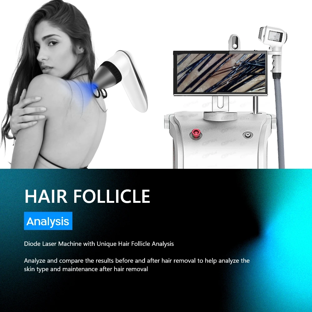 All colour painless treatment diode laser 808 hair removal machine price