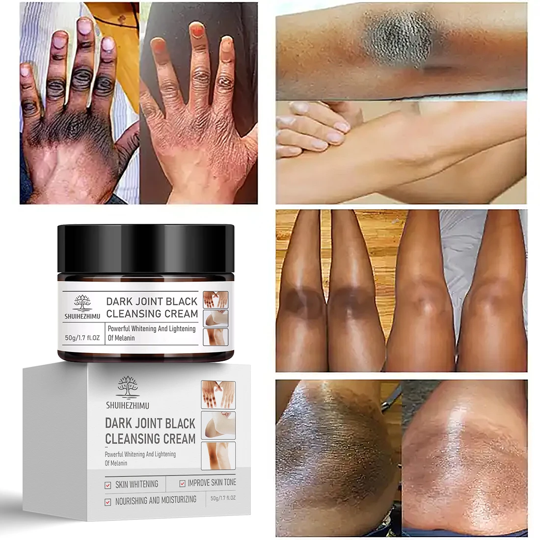 Body Whitening Cream Joint Underarm Legs Knee Elbow Brighten Armpit Bleaching Cream Remove Dark Spots Melanin Skincare Cream