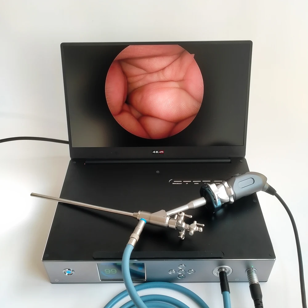 Medical portable Rigid Endoscope Sinuscope camera otoscope laryngoscope USB 3.0 Full HD 1920x1080P laparoscopic camera