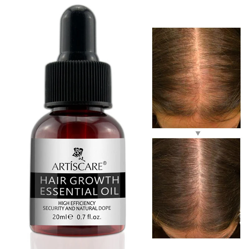 Private Label Herbal Painless Hair Care Serum Anti Hair Loss Treatment Fast Growing Germinal Hair Serum